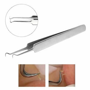 May include: A stainless steel comedone extractor tool with curved tips. The tool is designed for extracting blackheads and other skin impurities. A close-up inset shows the tool in use.