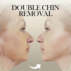 May include: Image showing a side-by-side comparison of a woman's profile before and after a double chin removal procedure. The text "DOUBLE CHIN REMOVAL" is displayed at the top. A white arrow indicates the transformation.