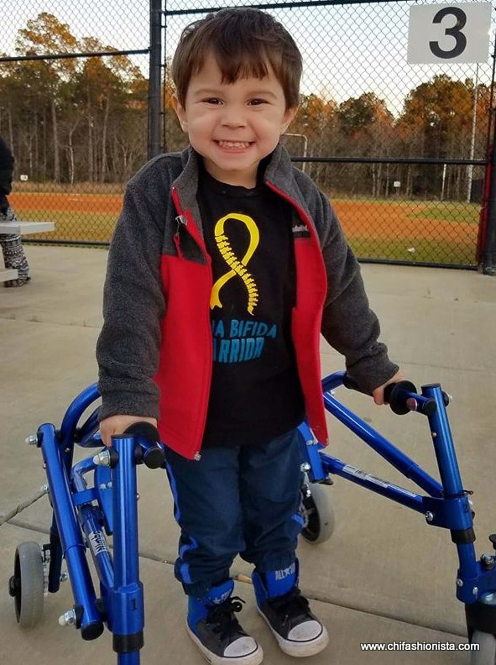 Rene Kirby, Spina Bifida Warrior, Dies Too Soon - hjj9e8s