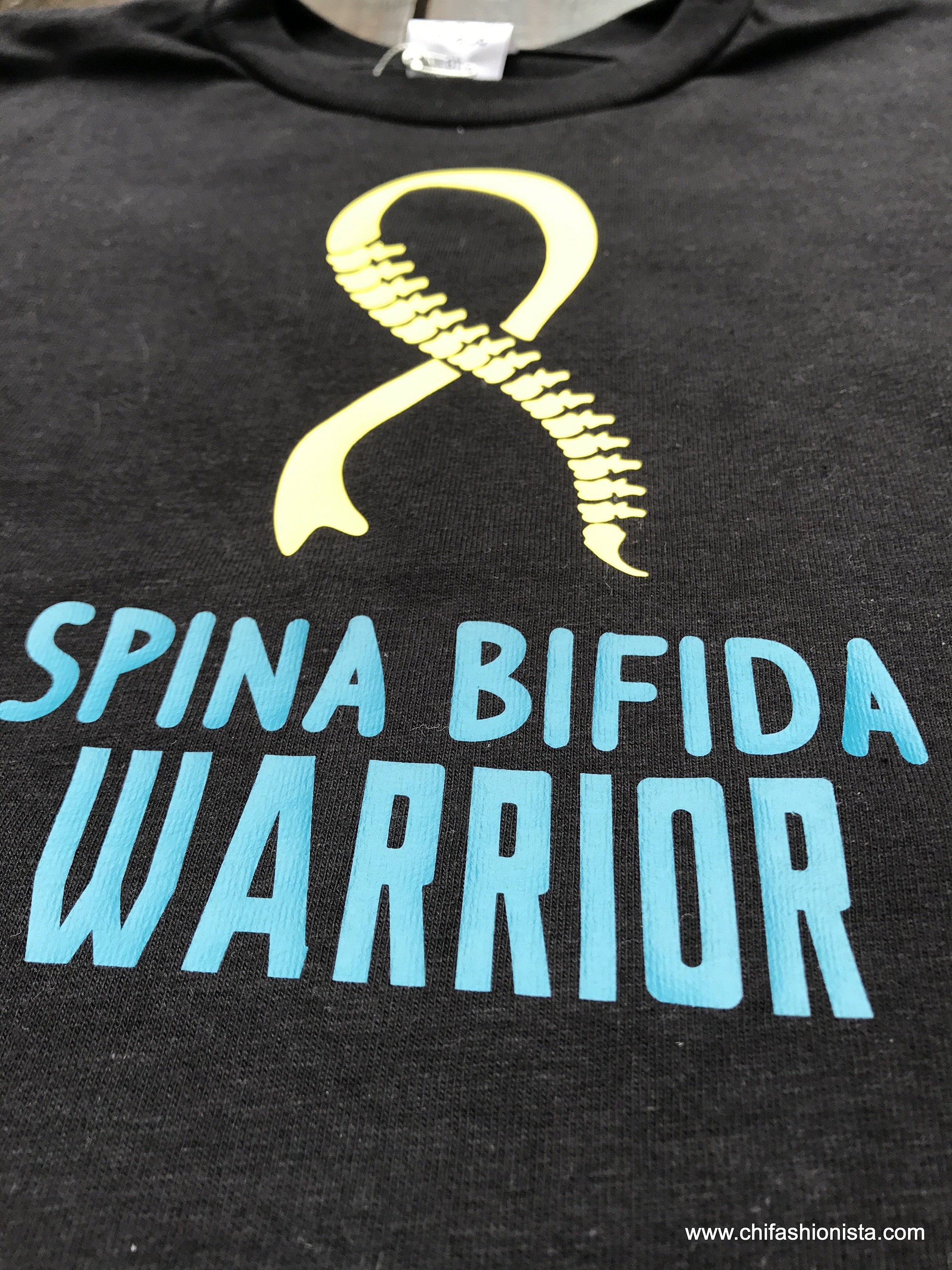 Rene Kirby, Spina Bifida Warrior, Dies Too Soon - y4q1hki