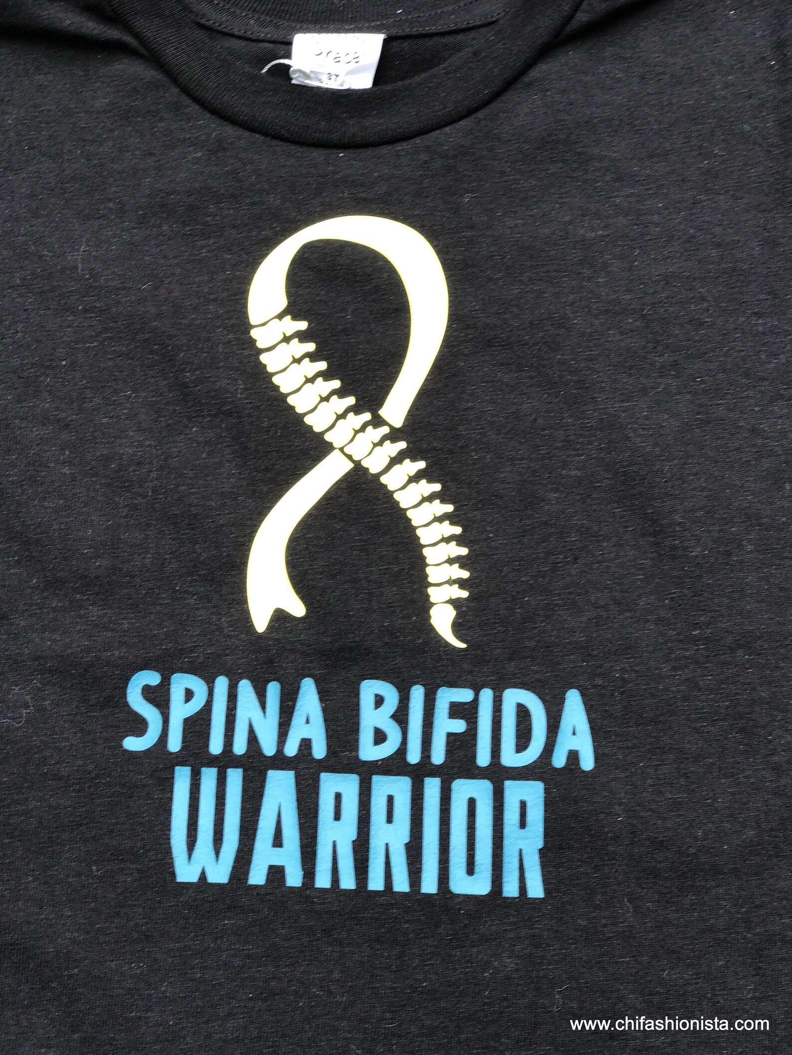 Rene Kirby, Spina Bifida Warrior, Dies Too Soon - ebw12zo
