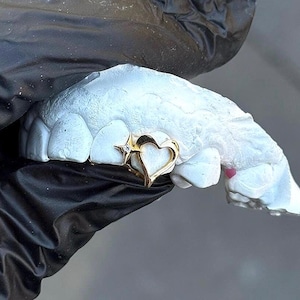 May include: A gold-coloured tooth charm in the shape of a heart is set on a light blue dental mould. The charm has a small star on the top left side of the heart. The mould is held by a gloved hand.