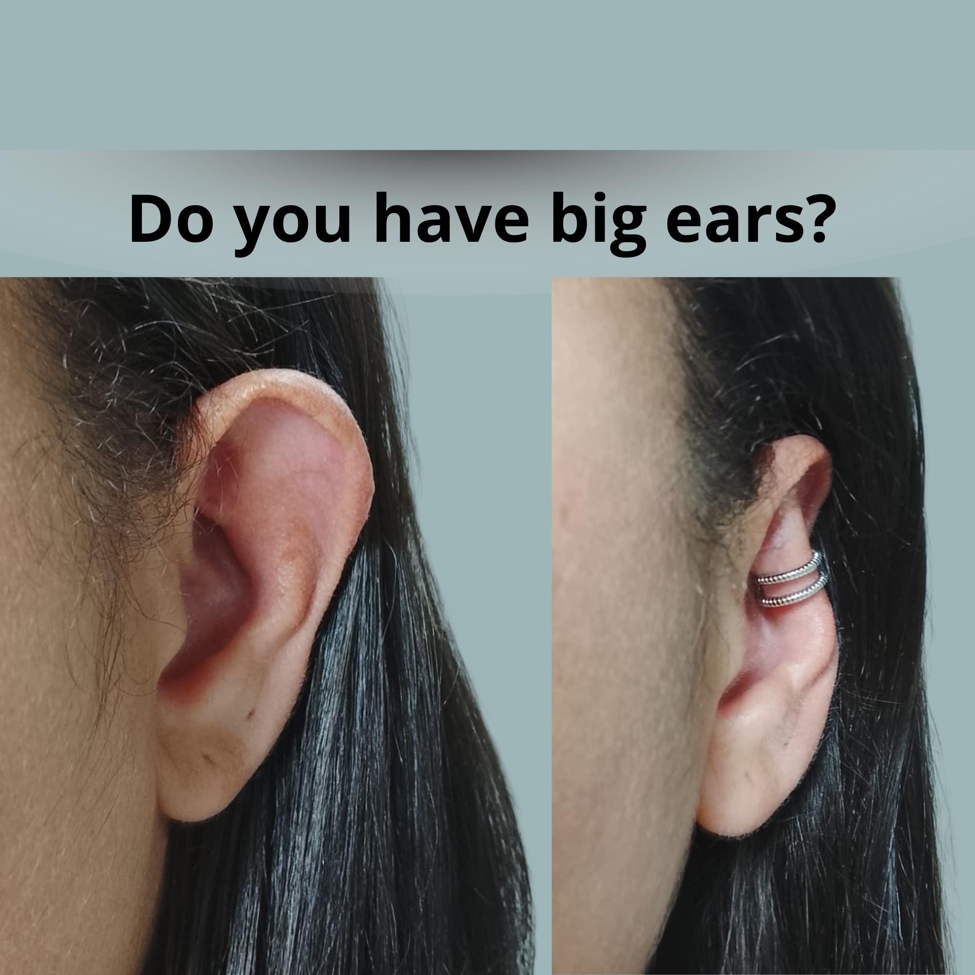 Ear clip for protruding ear - Etsy 日本