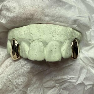 Puede incluir: Un molde dental con dos fundas de dientes doradas. El molde es de color verde claro y descansa sobre una superficie blanca texturizada. Las fundas est&aacute;n muy pulidas y reflejan la luz.