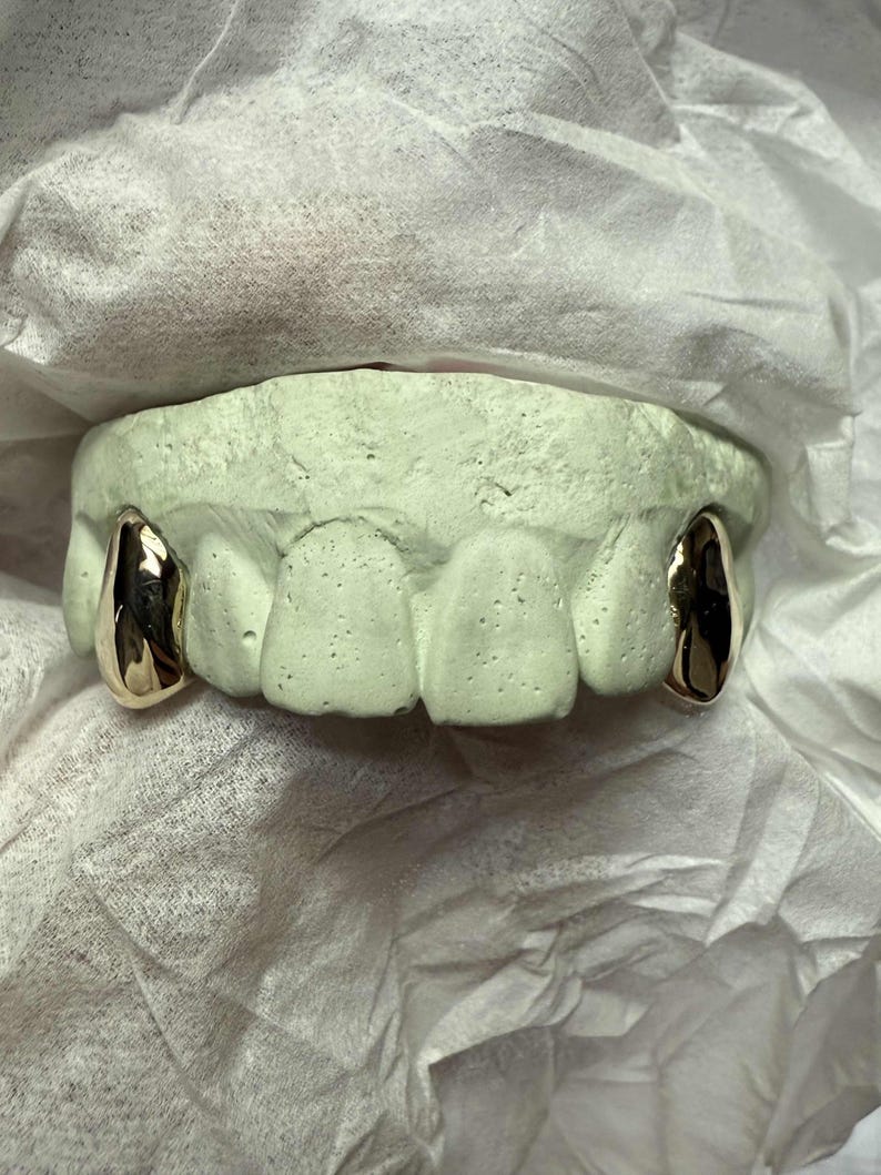 Puede incluir: Un molde dental con dos fundas de dientes doradas. El molde es de color verde claro y descansa sobre una superficie blanca texturizada. Las fundas est&aacute;n muy pulidas y reflejan la luz.
