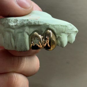 May include: Gold-colored dental grill with a star design on one tooth, set on a light green dental mold. The grill is highly polished and reflects light, showcasing a custom dental accessory.