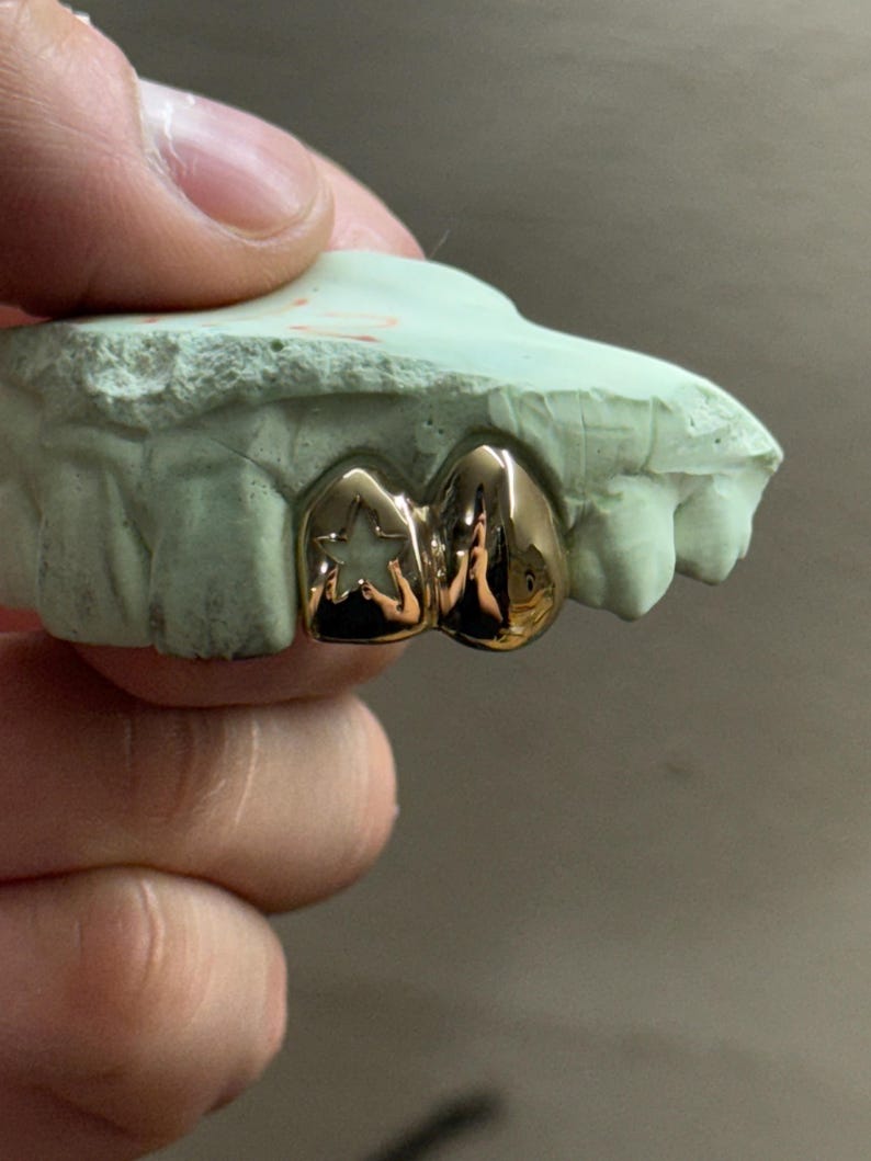 May include: Gold-colored dental grill with a star design on one tooth, set on a light green dental mold. The grill is highly polished and reflects light, showcasing a custom dental accessory.