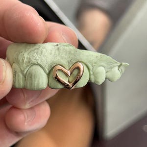 May include: A rose gold heart-shaped grill is set on a green dental mold. The grill is a delicate, open-heart design. The mold shows the impression of teeth.