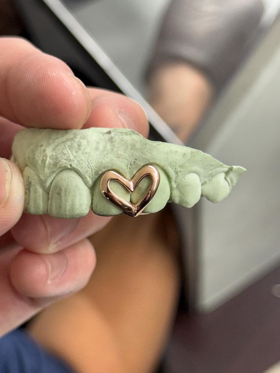 Custom Heart Open Face Grillz 925 Silver / Solid Gold.