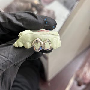 May include: Silver dental grill with a heart-shaped design on the top tooth, resting on a light green dental mold. The grill is held by a gloved hand, with a blurred background of a dental lab.