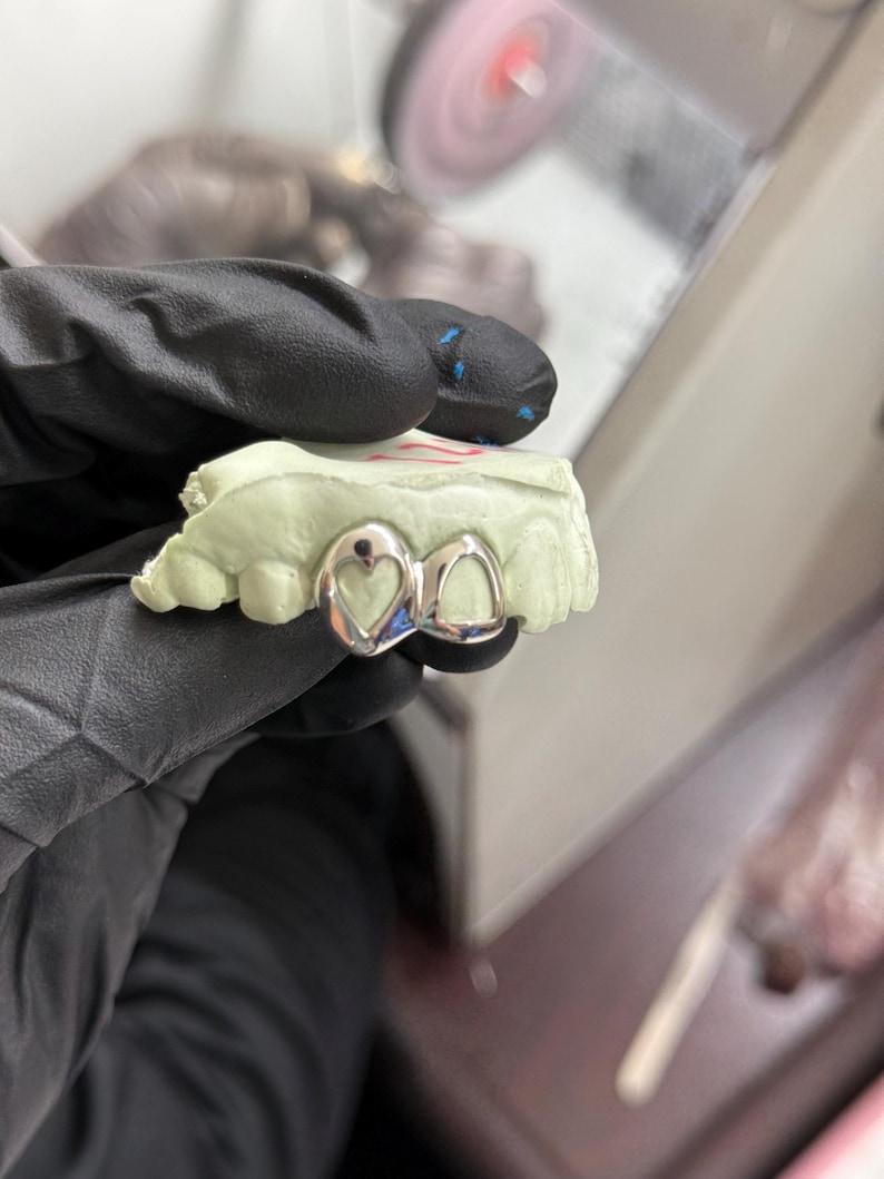 May include: Silver dental grill with a heart-shaped design on the top tooth, resting on a light green dental mold. The grill is held by a gloved hand, with a blurred background of a dental lab.