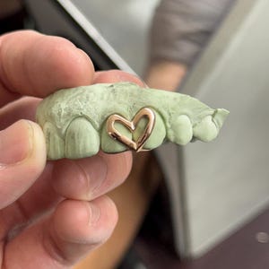 May include: A dental mold with a rose gold heart-shaped grill. The mold is light green and shows the impression of teeth. The heart grill is centered on the front teeth.