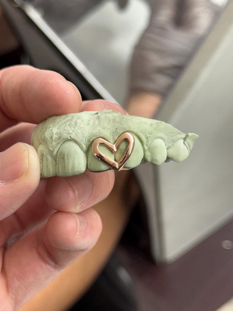 May include: A dental mold with a rose gold heart-shaped grill. The mold is light green and shows the impression of teeth. The heart grill is centered on the front teeth.