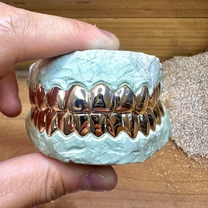 Puede incluir: Un juego de parrillas dentales de oro rosa pulido ajustadas sobre un molde dental de color verde claro. Las fundas met&aacute;licas para los dientes presentan una superficie lisa y reflectante que sigue la forma de las filas de dientes.