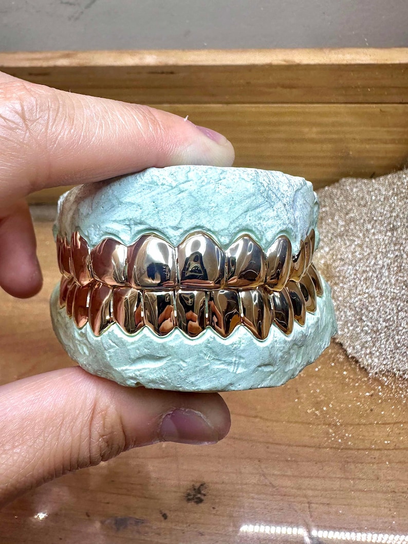 Puede incluir: Un juego de parrillas dentales de oro rosa pulido ajustadas sobre un molde dental de color verde claro. Las fundas met&aacute;licas para los dientes presentan una superficie lisa y reflectante que sigue la forma de las filas de dientes.