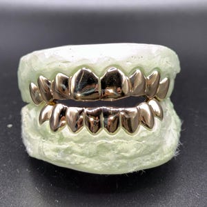Puede incluir: Un juego de fundas dentales de metal en tono dorado pulido ajustadas sobre un molde dental de color verde claro. Las fundas cubren las filas superior e inferior de los dientes, con una superficie lisa y reflectante que imita la forma natural.