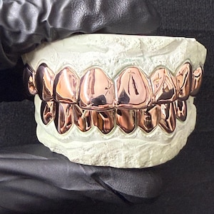 Puede incluir: Un conjunto de fundas dentales de metal color oro rosa ajustadas sobre un molde dental blanco. La superficie met&aacute;lica es altamente reflectante y cubre tanto la fila superior como la inferior de los dientes, con un acabado liso y pulido.