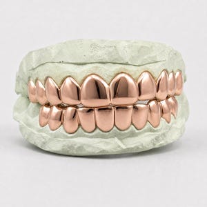 Puede incluir: Un juego de fundas dentales de metal color oro rosa ajustadas sobre un molde dental de color verde claro. Las fundas cubren las filas superior e inferior de los dientes, con una superficie met&aacute;lica lisa, pulida y reflectante.