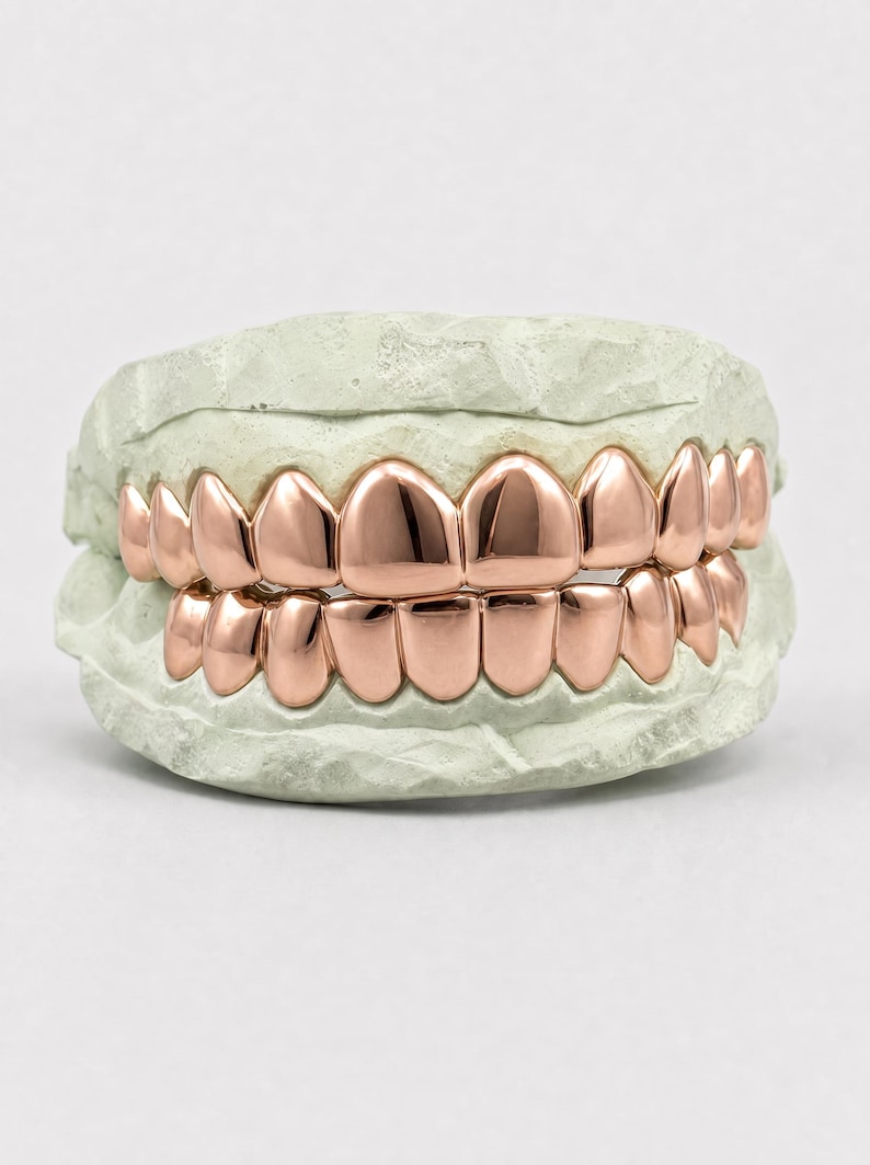 Puede incluir: Un juego de fundas dentales de metal color oro rosa ajustadas sobre un molde dental de color verde claro. Las fundas cubren las filas superior e inferior de los dientes, con una superficie met&aacute;lica lisa, pulida y reflectante.