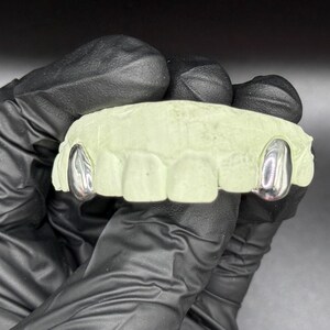 Puede incluir: Un molde dental con dos tapas de dientes plateadas. El molde es de color verde claro y tiene forma de dentadura. Las tapas son brillantes y reflejan la luz. El molde lo sostiene una persona con guantes negros.