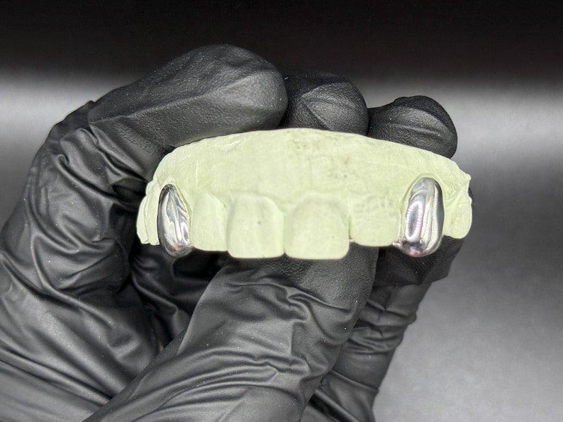 Puede incluir: Un molde dental con dos tapas de dientes plateadas. El molde es de color verde claro y tiene forma de dentadura. Las tapas son brillantes y reflejan la luz. El molde lo sostiene una persona con guantes negros.