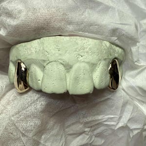 Puede incluir: Un molde dental verde claro con dos fundas dentales doradas. El molde descansa sobre una superficie blanca y texturizada. Las fundas doradas son muy reflectantes y parecen pulidas.