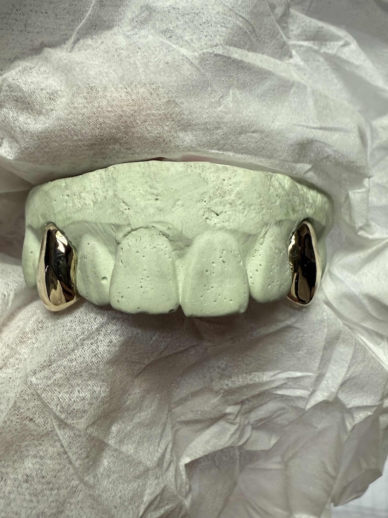 Puede incluir: Un molde dental verde claro con dos fundas dentales doradas. El molde descansa sobre una superficie blanca y texturizada. Las fundas doradas son muy reflectantes y parecen pulidas.