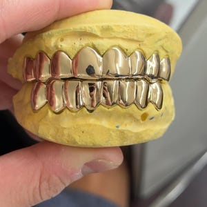Puede incluir: Un conjunto de parrillas dentales de color oro pulido ajustadas sobre los dientes superiores e inferiores de un molde dental amarillo. La parrilla met&aacute;lica cubre ocho dientes en la fila superior y ocho en la inferior, reflejando luz en su superficie.