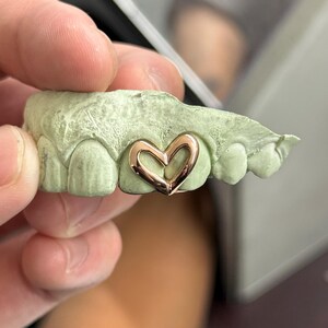 May include: A gold-colored heart-shaped tooth grill is set on a green dental mold. The heart grill is a delicate, open design, showcasing a polished finish. The mold provides a clear view of the grill's fit and form.