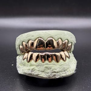 Puede incluir: Un conjunto de fundas dentales de metal color oro ajustadas sobre un molde dental de yeso verde claro. Las fundas cubren los dientes superiores e inferiores, con una superficie lisa y reflectante que imita la forma de los dientes en posici&oacute;n cerrada.
