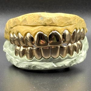 Puede incluir: Un juego de parrillas dentales de color oro rosa pulido ajustadas sobre un molde dental beige y verde claro. Las parrillas met&aacute;licas cubren los dientes superiores e inferiores, con una superficie lisa y reflectante que capta la luz en cada pieza.