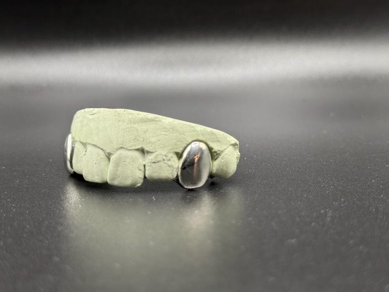 Puede incluir: Un molde dental con tres fundas de dientes plateadas. El molde es de color verde claro y est&aacute; sobre una superficie oscura. Las fundas son lisas y reflectantes, contrastando con la textura mate del molde.