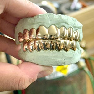 Puede incluir: Un juego de fundas dentales de color dorado pulido ajustadas sobre un molde dental de yeso verde claro. Las cubiertas met&aacute;licas para los dientes est&aacute;n moldeadas para adaptarse a las arcadas superior e inferior, con una superficie lisa y brillante.