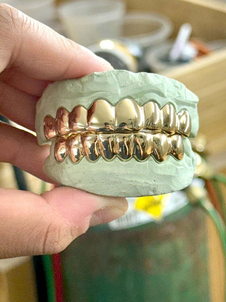 Puede incluir: Un juego de fundas dentales de color dorado pulido ajustadas sobre un molde dental de yeso verde claro. Las cubiertas met&aacute;licas para los dientes est&aacute;n moldeadas para adaptarse a las arcadas superior e inferior, con una superficie lisa y brillante.