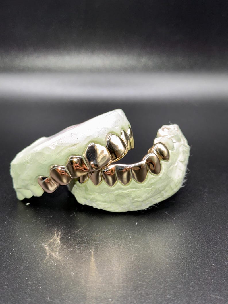 Puede incluir: Un juego de fundas dentales color oro ajustadas sobre un molde dental de yeso verde p&aacute;lido. Las cubiertas met&aacute;licas para los dientes est&aacute;n pulidas y son reflectantes, mostrando los contornos de las arcadas dentales superior e inferior.