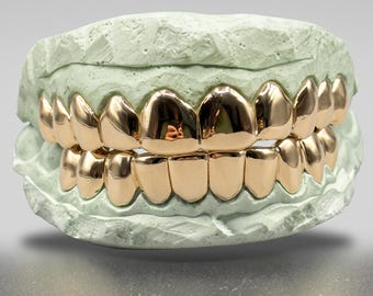 Custom Fit Solid Gold Grillz: 10K, 14K, 18K - Perm Cut - Etsy