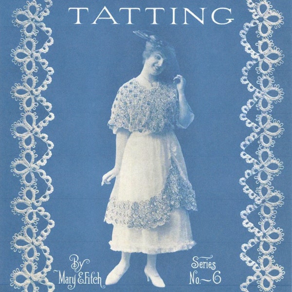 Tatting Pattern Book From 1916 Instant Download PDF