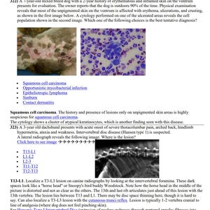 Puede incluir: Primer plano de una imagen microscópica que muestra un grupo de queratinocitos atípicos. La imagen es una muestra de citología de un perro con carcinoma de células escamosas.