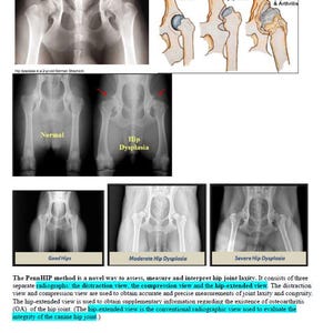 Puede incluir: Imágenes de rayos X de las caderas de un perro que muestran diferentes etapas de displasia de cadera. Las imágenes muestran una cadera normal, una cadera con displasia leve y una cadera con displasia severa. El texto 'Displasia de cadera, Pastor Alemán' está en la parte superior de la imagen.