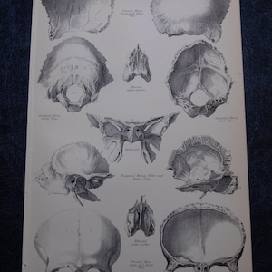 Cráneo - Placa de libro victoriana original - década de 1870-90, Medicina, Anatomía