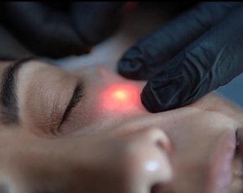 Endolift fibrelift training manual
