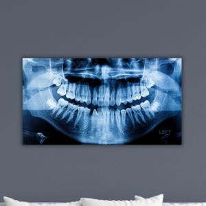 Lienzo de radiografía dental, póster de radiografía dental, impresión de radiografía dental, decoración de pared para sala de estar, decoración de pared para consultorio dental, arte de pared de radiografía dental