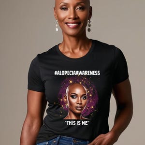 Alopecia Awareness T-shirt, Unisex Garment-Dyed Tee, Empowerment Shirt, Self-Love Apparel, Supportive Fashion, Alopecia Shirt