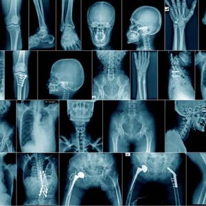 May include: A collage of various x-ray images showing different parts of the human body, including bones, joints, and internal organs.