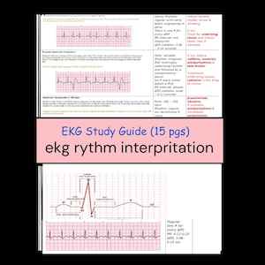 Interpretación de ECG Ritmo ECG l Escuela de Enfermería, EMT, EMS, Enfermera, Estudiante de Enfermería (15 páginas) PDF - Hoja de referencia de ECG Guía de estudio de ECG - ACLs/Bls