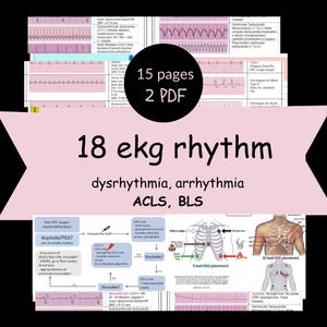 EKG Study Guide for Nursing Students BLS/ACLS Rhythms, Interventions, Nursing School & ekg for emt, ems, nurse - pdf (15 pages)