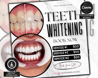 May include: A digital marketing graphic for teeth whitening services. The graphic features before and after photos of teeth, a marble background, and the text "TEETH WHITENING" in bold black letters. The text "BOOK NOW" is also included, along with pricing for three different services.