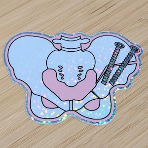 Hip Dysplasia Sticker, PAO Ganz Sticker, Periacetabular Osteotomy, Pelvis, Hip Surgery, Gift for PAO Hip Dysplasia Patient