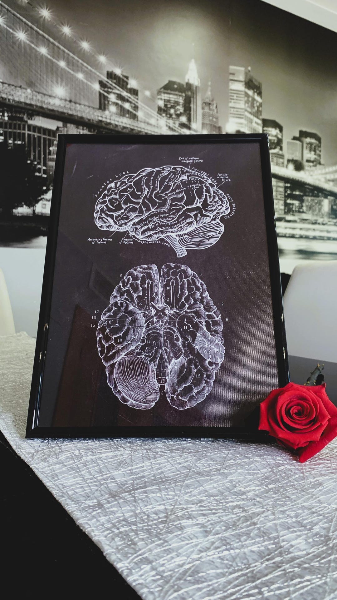 Vintage Brain Anatomy Poster With Frame – Elegant Medical Wall Art for ...