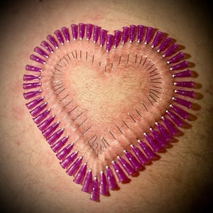 May include: A heart shape formed by a large number of purple needles inserted into skin.